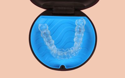 Invisalign Attachments: What Are They and Why Are They Used?